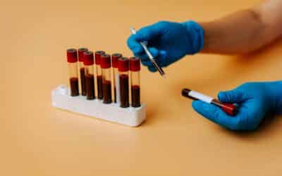 Why Does My Pet Need Bloodwork? Understanding Veterinary Diagnostic Testing in Charlotte NC