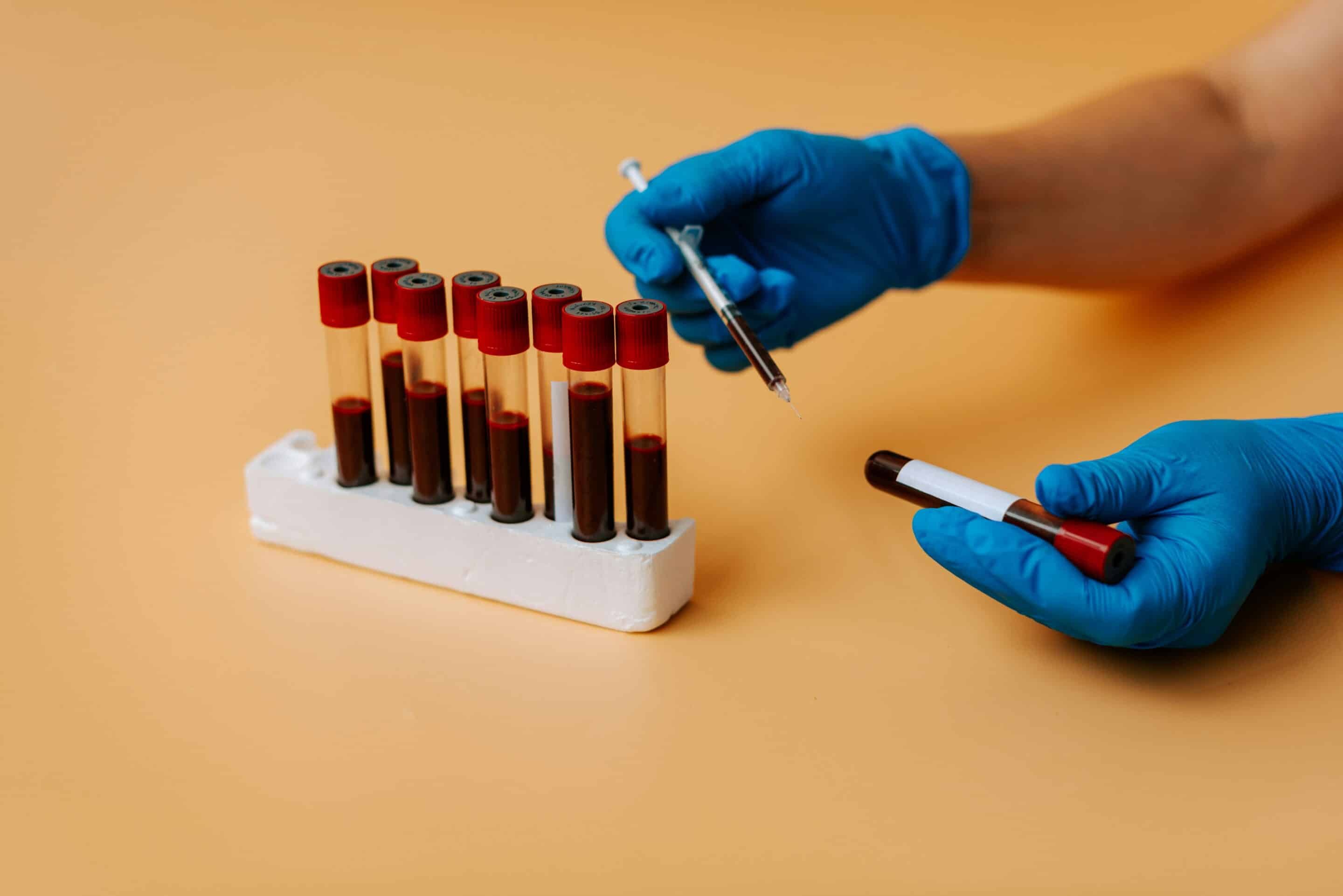 Bloodwork samples from pets for testing
